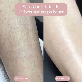 SensiCare - Intimrakning utan irritation